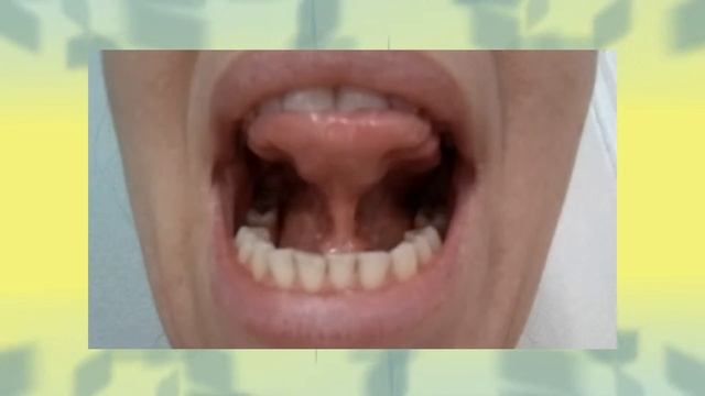 Артикуляционная гимнастика. Часть 3