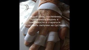 Как распрямить руку после инсульта или травмы?