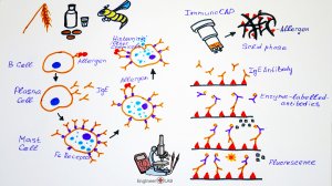 Allergy Diagnostics and Phadia 250