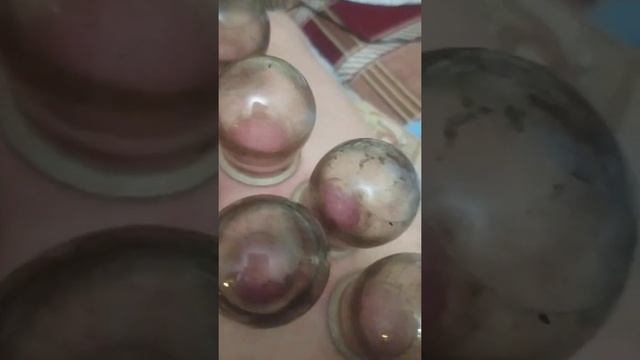 ставим банки смотреть онлайн