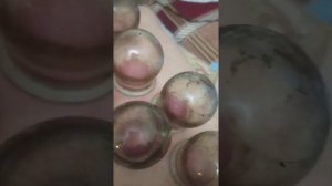 ставим банки