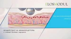 Что происходит с телом во время процедуры Elosmodul_