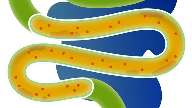 ФИТОМУЦИЛ НОРМ как действует смотреть онлайн