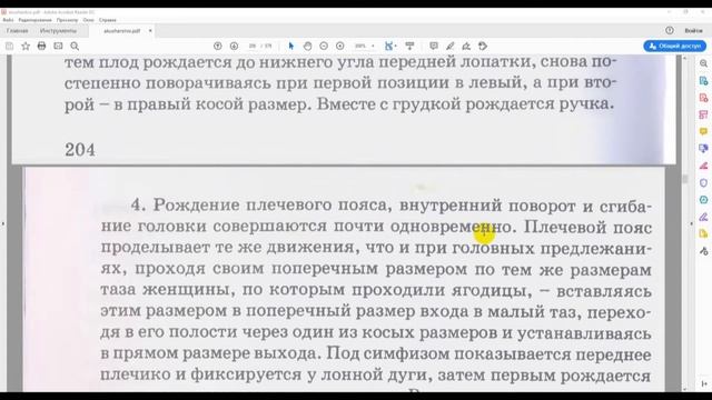 Биомеханизм родов при тазовых предлежаниях смотреть онлайн