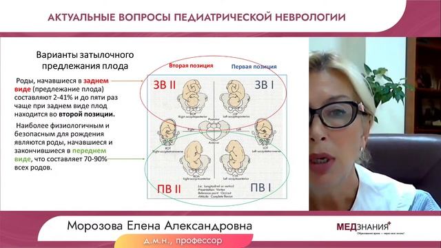 Актуальные вопросы педиатрической неврологии