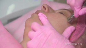 Аппарат газожидкостного пилинга PowerPeel ES-921-А
