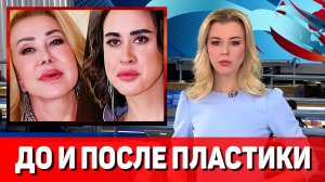 Дочь Успенской Татьяна Плаксина до и после пластики