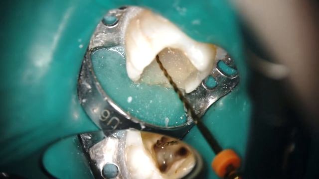 отломок и ТСА техника смотреть онлайн