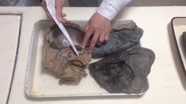 Дыхательная система ...кусками смотреть онлайн