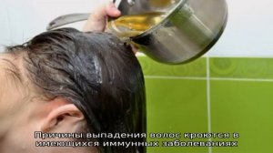 Что делать, если волосы выпадают с луковицей? Вырастут ли они снова?