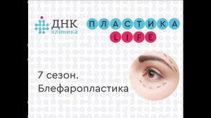 7 сезон проекта "ПЛАСТИКА Life". Блефаропластика