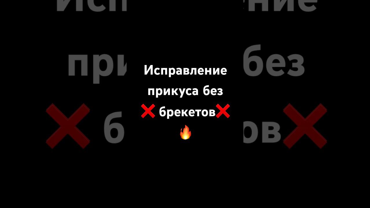 ИСПРАВЛЯЕМ ПРИКУС БЕЗ БРЕКЕТОВ ✅ #элайнеры #москва #стоматологиямосква #ортодонтическоелечение