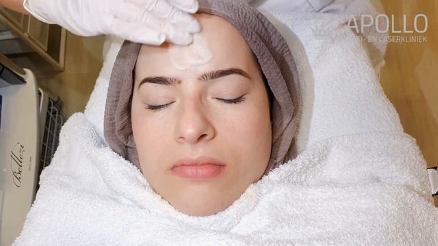 Dermaceutic Milk Peeling смотреть онлайн