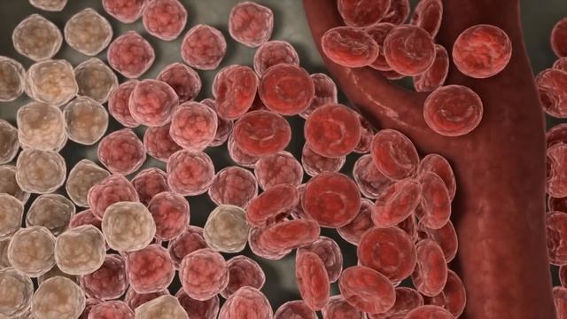 What is blood cancer? смотреть онлайн