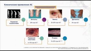 Аксиальный спондилоартрит