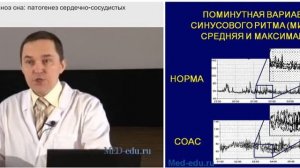 2_Синдром обструктивного апноэ сна: патогенез сердечно сосудистых осложнений. Р.В. Бузунов