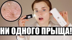 Ну и ПОЧЕМУ блогеры ЭТО так хвалят? КОЖА под МИКРОСКОПОМ!