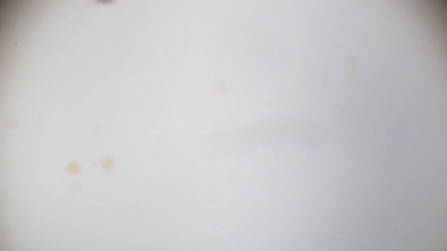 ЧТО НАХОДИТСЯ В КАПЛЕ ВОДЫ С ЧИСТОГО И ГРЯЗНОГО КОЛОДЦА ПОД МИКРОСКОПОМ смотреть онлайн