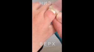 Как снять кольцо с опухшего пальца