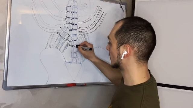 Как лечить Сколиоз? Причины Идиопатического сколиоза