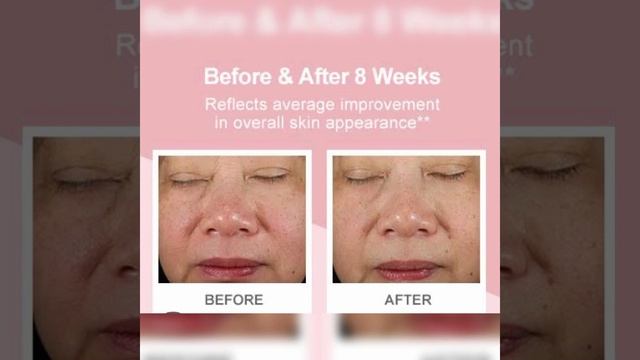 Before and after use of Vitamin E ( Evion capsules) смотреть онлайн