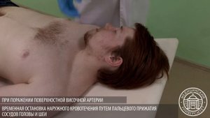 Остановка наружного кровотечения путём пальцевого прижатия сосудов головы и шеи