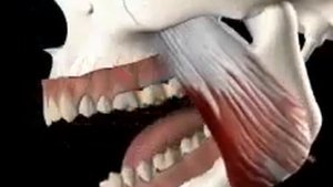 Зубной мост   что это  Протезирование зубными мостами в Сумах