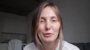 брекеты спустя 4 месяца. результат выравнивания зубов