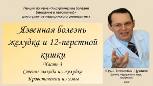 Язва желудка и 12-ти перстной кишки, часть 3. Для студентов медуниверситета.