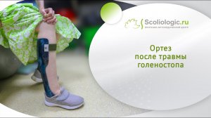 Ортезирование после травм_ возможность движения без боли и отеков
