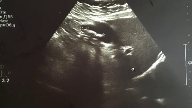 Запис 2020 03 04 07 44 44 394 смотреть онлайн