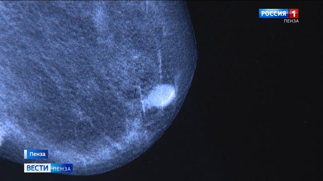 «Быть здоровым – здорово»: пензенские онкологи освоили передовую методику борьбы с раком груди смотреть онлайн