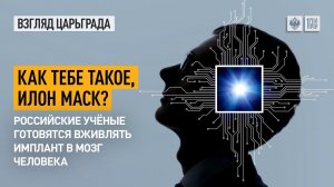 Как тебе такое, Илон Маск? Российские учёные готовятся вживлять имплант в мозг человека