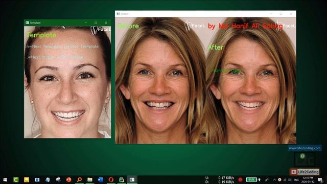 Image Processing Based Teeth Replacement or Augmentation using Python OpenCV