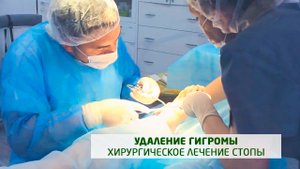 Удаление гигромы стопы