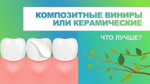 ? Композитные виниры или керамические.Что лучше?