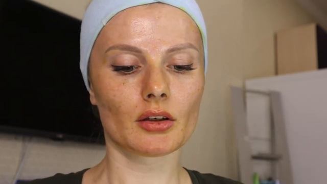 Я косметолог. Фракционная мезо терапия 2 процедура. смотреть онлайн