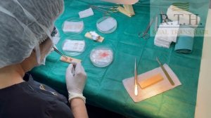 Что происходит с графтами❓