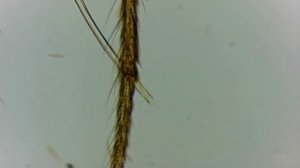 Ротовой аппарат комара The oral apparatus of a mosquito
