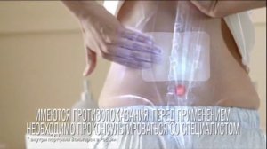 (2015) Пластырь Вольтарен - Свобода движения