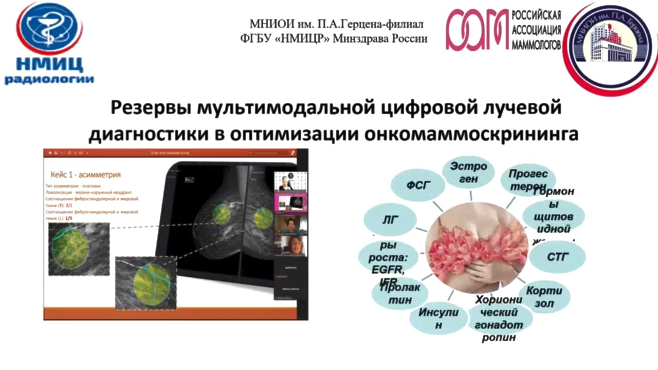 Резервы мультимодальной цифровой лучевой диагностики в оптимизации онкомаммоскрининга