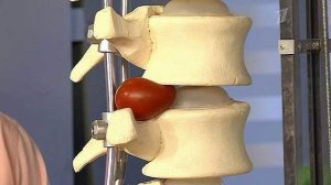 Зарядка против боли в пояснице. Жить здорово! Фрагмент выпуска от 25.02.2015