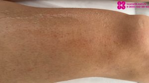 Обзор аппарата DDS-011