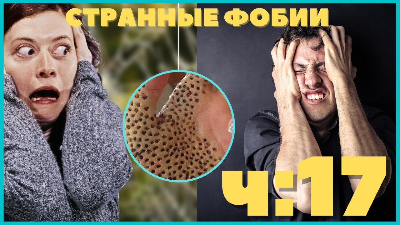 Странные Фобии _ Часть 17 _ Хайрофобия  _ боязнь засмеяться...