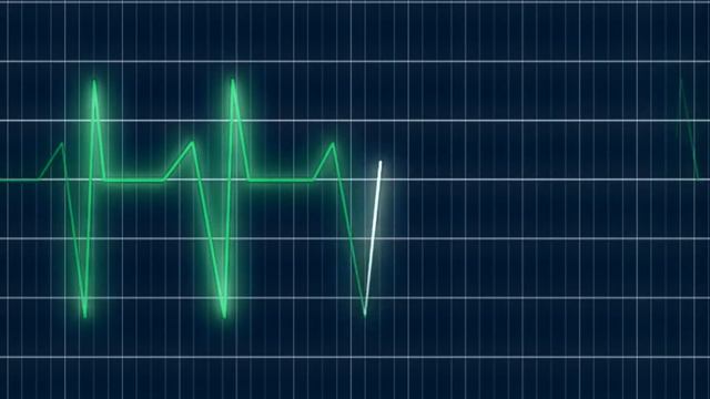Звуки биения сердца / Cердцебиение звук / Heartbeat sound