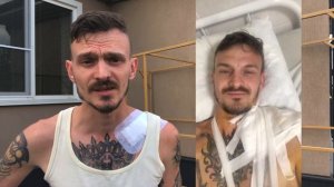 Первая серьезная травма, сломал ключицу. Монолог после 4#