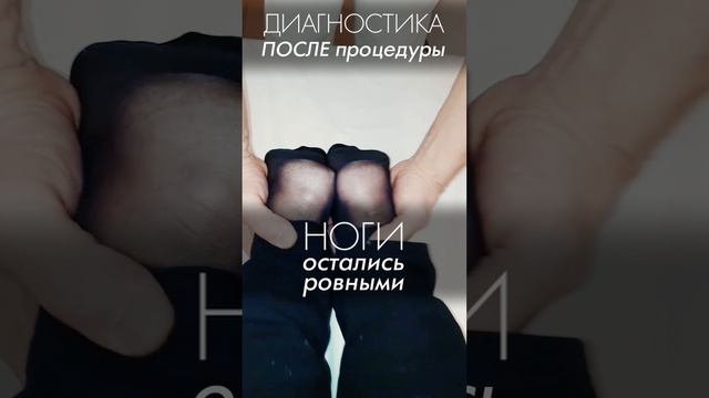 Ой, не то слово, как легче стало! Полный блок атланта. Таз перекошен. Акупрессура подзатылочных мышц