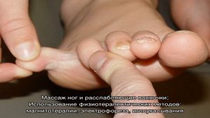 Неврома Мортона стопы