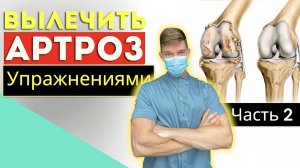 Упражнения при артрозе суставов. Часть 2. Варианты лечения без операции.