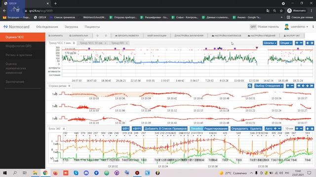 Инструкция: как уменьшить масштаб страницы. смотреть онлайн